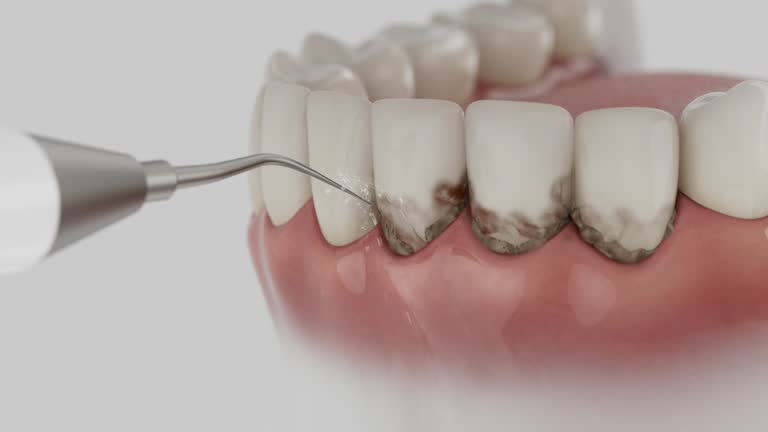 Reliable Dental contractor in Schuyler County County, MO by Dentist Open Now